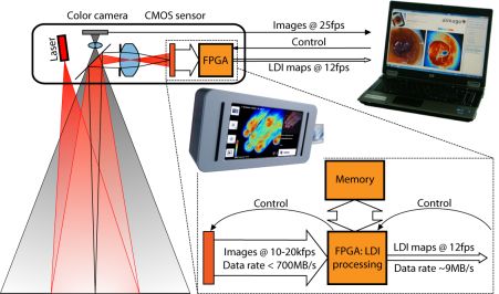 Amago laser Doppler imager.