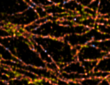 Alexa647-labeled alpha-tubulin in fixed HeLa cells